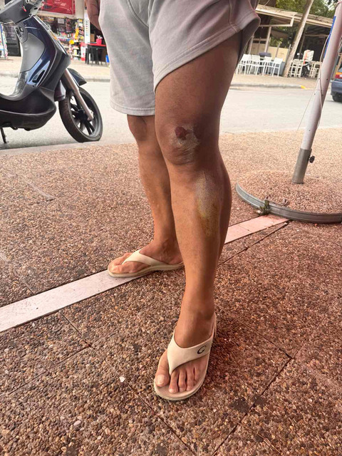 Επίθεση αδέσποτων στο κέντρο της πόλης οδήγησε στην πτώση οδηγού μηχανής! 